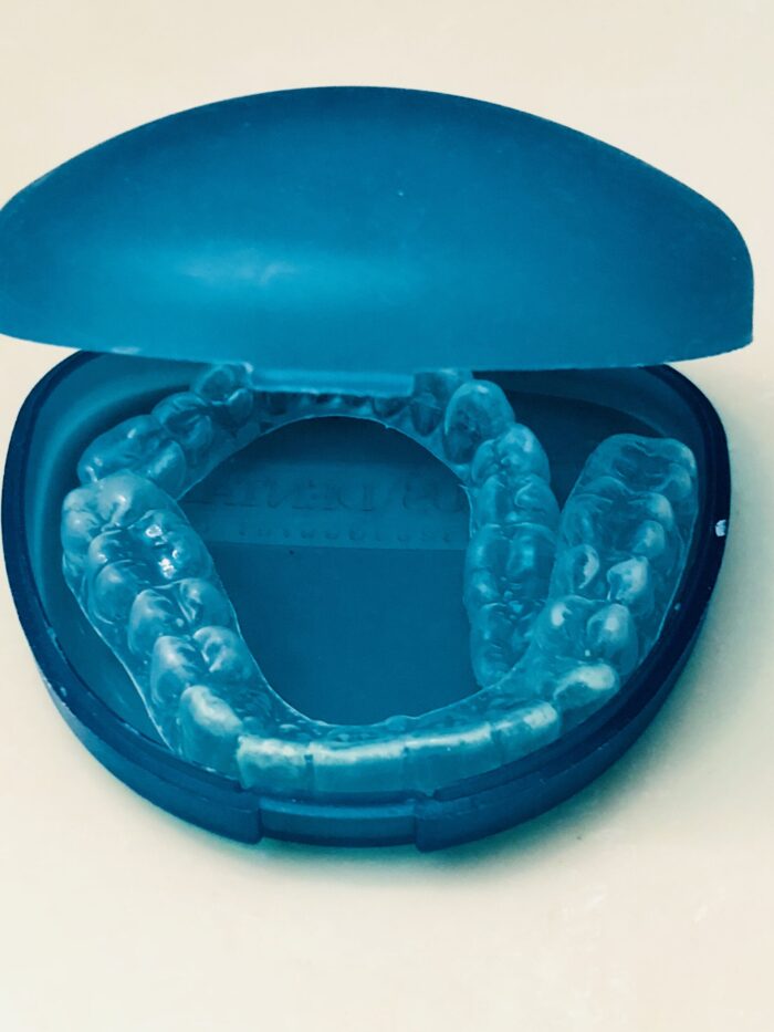 Curated visual reference: Visual Reference: How A Custom Mouth Guard Can Improve Your Sleep And